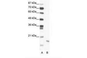 Image no. 1 for anti-Second Mitochondria-Derived Activator of Caspase (DIABLO) (C-Term) antibody (ABIN203000) (DIABLO anticorps  (C-Term))