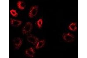 Immunofluorescent analysis of ATF6 staining in A549 cells. (ATF6 anticorps)