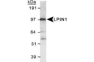 Western blot analysis of LPIN1 in 3T3-L1 lysate using LPIN1 polyclonal antibody . (Lipin 1 anticorps  (AA 500-600))