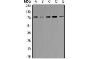 Western blot analysis of NRG1 expression in HEK293T (A), AD293 (B), Hela (C), HepG2 (D), 22RV1 (E) whole cell lysates. (Neuregulin 1 anticorps  (N-Term))