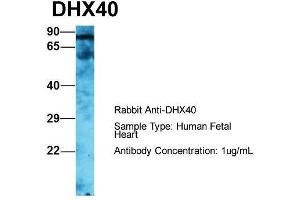 Host: Rabbit  Target Name: DHX40  Sample Tissue: Human Fetal Heart  Antibody Dilution: 1. (DEAH (Asp-Glu-Ala-His) Box Polypeptide 40 (DHX40) (C-Term) anticorps)