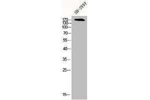 Western Blot analysis of SH-SY5Y cells using CFTR Polyclonal Antibody (CFTR anticorps)
