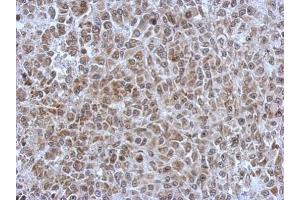 IHC-P Image Immunohistochemical analysis of paraffin-embedded HBL435 xenograft, using POM121, antibody at 1:500 dilution.