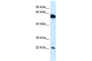 Western Blot showing NICN1 antibody used at a concentration of 1. (NICN1 anticorps  (Middle Region))