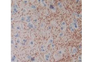 IHC-P analysis of Human Tissue, with DAB staining. (HAP1 anticorps  (AA 160-381))