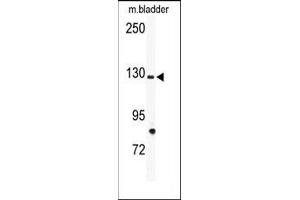 Image no. 1 for anti-tyrosine Kinase with Immunoglobulin-Like and EGF-Like Domains 1 (TIE1) (N-Term) antibody (ABIN359947)