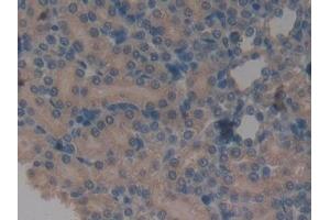 Detection of a1BG in Rat Kidney Tissue using Monoclonal Antibody to Alpha-1-B-Glycoprotein (a1BG)