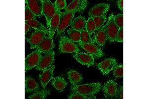 Immunofluorescence Analysis of PFA-fixed HeLa cells labeling Moesin with Moesin Mouse Monoclonal Antibody (MSN/491) followed by Goat anti-Mouse IgG-CF488 (Green).