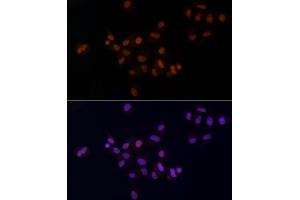 Immunofluorescence analysis of A-549 cells using METTL14 Rabbit pAb (ABIN6131104, ABIN6143759, ABIN6143760 and ABIN6224625) at dilution of 1:25 (40x lens).