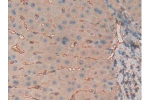 Detection of b2M in Human Liver Tissue using Polyclonal Antibody to Beta-2-Microglobulin (b2M)