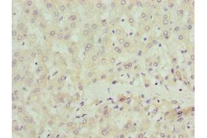 Immunohistochemistry of paraffin-embedded human liver tissue using ABIN7169907 at dilution of 1:100 (Sclt1 anticorps  (AA 1-79))
