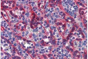 Human Spleen: Formalin-Fixed, Paraffin-Embedded (FFPE)