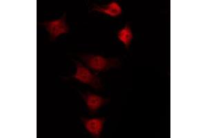 ABIN6266457 staining K562 by IF/ICC.