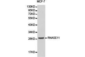 Western Blotting (WB) image for anti-Ribonuclease, RNase A Family, 11 (Non-Active) (RNASE11) antibody (ABIN1874613) (RNASE11 anticorps)