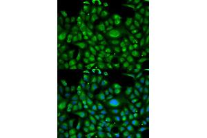 Immunofluorescence analysis of U2OS cell using HSPA1L antibody.