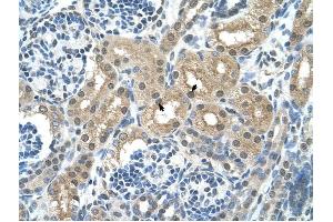 GPT antibody was used for immunohistochemistry at a concentration of 4-8 ug/ml to stain Epithelial cells of renal tubule (arrows) in Human Kidney. (ALT anticorps)