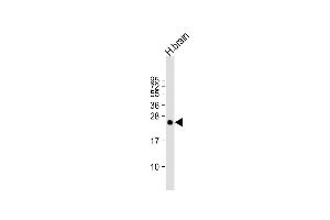 Anti-PLD6 Antibody (Center) at 1:2000 dilution + human brain lysate Lysates/proteins at 20 μg per lane.