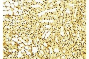 ABIN6275841 at 1/100 staining Mouse liver tissue by IHC-P. (DRAK2 anticorps  (C-Term))