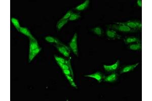 Immunofluorescent analysis of Hela cells using ABIN7146536 at dilution of 1:100 and Alexa Fluor 488-congugated AffiniPure Goat Anti-Rabbit IgG(H+L)