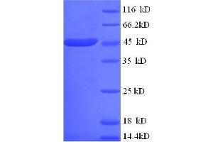 SDS-PAGE (SDS) image for Creatine Kinase, Mitochondrial 1A (CKMT1A) (AA 40-417) protein (His tag) (ABIN5712708)