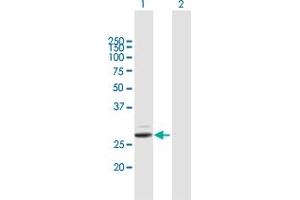 Western Blot analysis of PRSS2 expression in transfected 293T cell line by PRSS2 MaxPab polyclonal antibody.