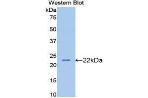 Detection of Recombinant APOB, Rat using Monoclonal Antibody to Apolipoprotein B (APOB)