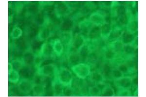 Immunofluorescence (IF) image for anti-Caspase 12 (Gene/pseudogene) (CASP12) (AA 95-318), (N-Term) antibody (ABIN567795) (Caspase 12 anticorps  (N-Term))