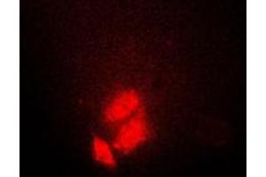 anti-TSC22 Domain Family, Member 1 (TSC22D1) (C-Term) antibody