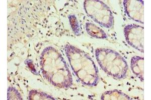 Immunohistochemistry of paraffin-embedded human colon tissue using ABIN7143353 at dilution of 1:100 (ADSS anticorps  (AA 1-280))