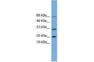 WB Suggested Anti-PRR13 Antibody Titration: 0.
