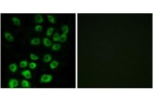 Immunofluorescence analysis of MCF7 cells, using ARFGAP1 Antibody. (ARFGAP1 anticorps  (AA 171-220))