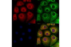 ABIN6260109 and ABIN6278114 staining Hela cells by IF/ICC. (ATG9A anticorps  (Internal Region))