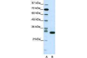 WB Suggested Anti-CDK5 Antibody Titration:  1. (CDK5 anticorps  (N-Term))