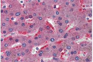 Human Liver: Formalin-Fixed, Paraffin-Embedded (FFPE)