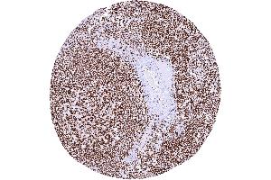 Lymph node showing a strong PARP1 staining of lymphocytic and other cells (Recombinant PARP1 anticorps)