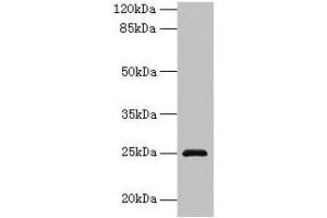 Western blot All lanes: RAB32 antibody at 3 μg/mL + Mouse kidney tissue Secondary Goat polyclonal to rabbit IgG at 1/10000 dilution Predicted band size: 25 kDa Observed band size: 25 kDa (RAB32 anticorps  (AA 2-225))