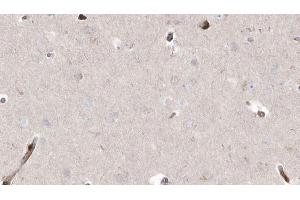 anti-Abhydrolase Domain Containing 5 (ABHD5) (Internal Region) antibody