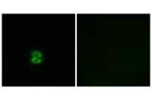 Immunofluorescence analysis of A549 cells, using CHST6 antibody. (CHST6 anticorps)