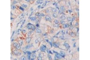 IHC-P analysis of Human Tissue, with DAB staining. (Lrig1 anticorps  (AA 739-995))