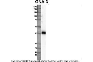 Sample Type: Nthy-ori cell lysate (50ug)Primary Dilution: 1:1000Secondary Antibody: anti-rabbit HRPSecondary Dilution: 1:2000Image Submitted By: Anonymous (GNAI3 anticorps  (Middle Region))