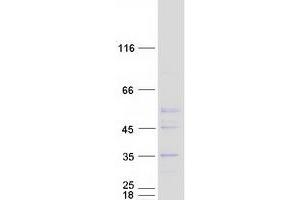 Validation with Western Blot