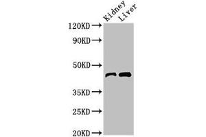 Western Blot Positive WB detected in: Mouse kidney tissue, Mouse liver tissue All lanes: BLZF1 antibody at 3 μg/mL Secondary Goat polyclonal to rabbit IgG at 1/50000 dilution Predicted band size: 45, 20 kDa Observed band size: 45 kDa