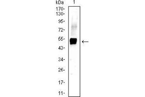 Western blot analysis using KRT13 mouse mAb against A431 (1) cell lysate. (Cytokeratin 13 anticorps  (AA 104-458))