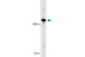 Western blot analysis of CASP8AP2 in HeLa whole cell lysates with CASP8AP2 polyclonal antibody  at 0. (FLASH anticorps  (C-Term))