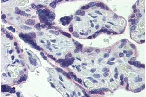 Placenta, Human: Formalin-Fixed, Paraffin-Embedded (FFPE)