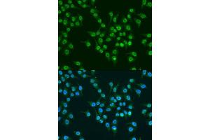 Immunofluorescence analysis of U2OS cells using KLF4 antibody.