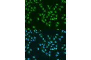 Immunofluorescence analysis of U2OS cells using KLF4 antibody. (KLF4 anticorps  (AA 180-479))