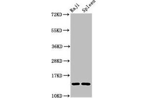 Western Blot Positive WB detected in: Raji whole cell lysate, Rat spleen tissue All lanes: GABARAPL2 antibody at 4 μg/mL Secondary Goat polyclonal to rabbit IgG at 1/50000 dilution Predicted band size: 14 kDa Observed band size: 14 kDa (GABARAPL2 anticorps  (AA 1-117))