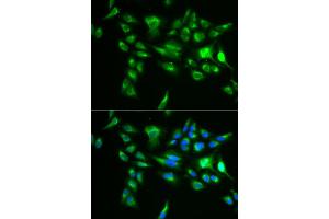 Immunofluorescence analysis of U2OS cell using POLG2 antibody. (POLG2 anticorps)