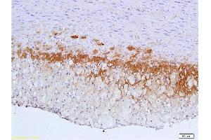Formalin-fixed and paraffin embedded: rabbit carotid artery labeled with Anti-TGF-beta-R2/TGFBR2 Polyclonal Antibody , Unconjugated 1:600 followed by conjugation to the secondary antibody and DAB staining (TGFBR2 anticorps  (AA 241-330))
